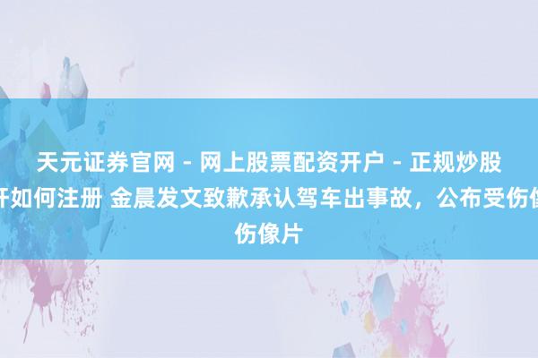 天元证券官网 - 网上股票配资开户 - 正规炒股杠杆如何注册 金晨发文致歉承认驾车出事故，公布受伤像片